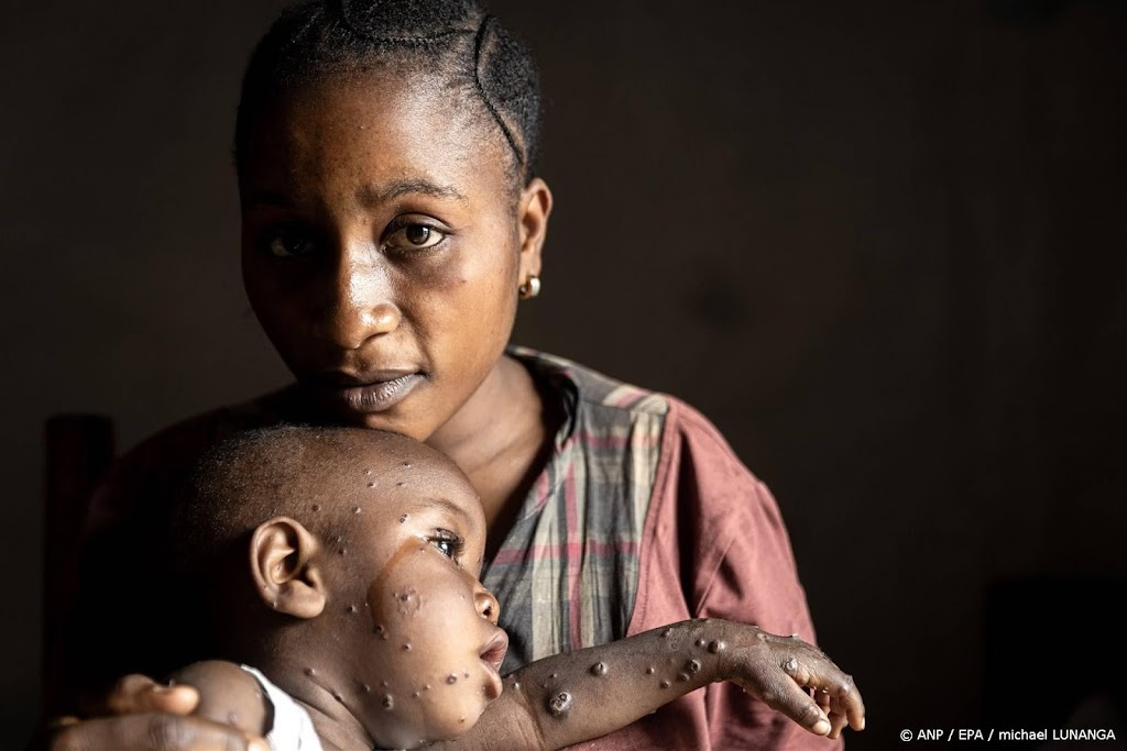 Eerste mpox-vaccins voor Congo donderdag verwacht