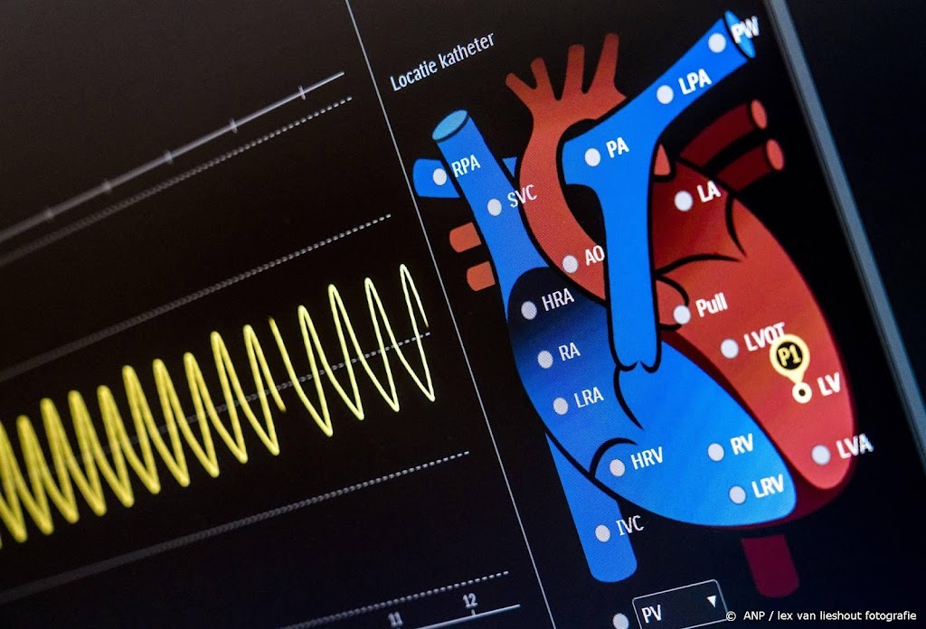 Onderzoek oversterfte hartpatiënten, maar inzien data is probleem