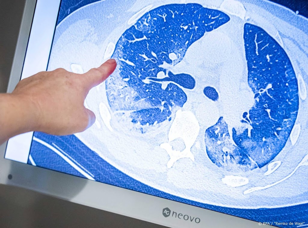 Kunstmatige intelligentie bekijkt schade in longen coronapatiënt