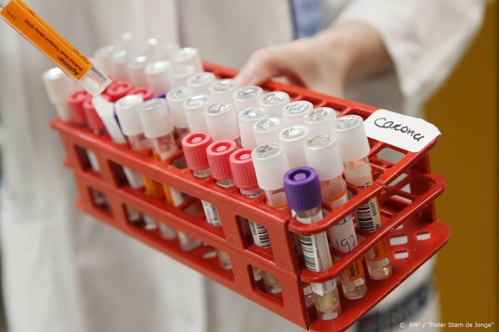 Britse regering steekt 131 miljoen pond in vaccinproductie