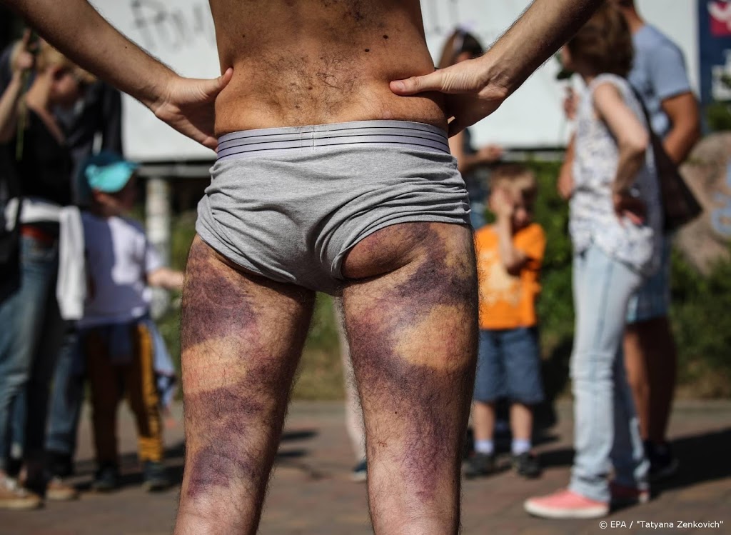 EU wil onderzoek Wit-Rusland naar mishandeling in detentiecentra