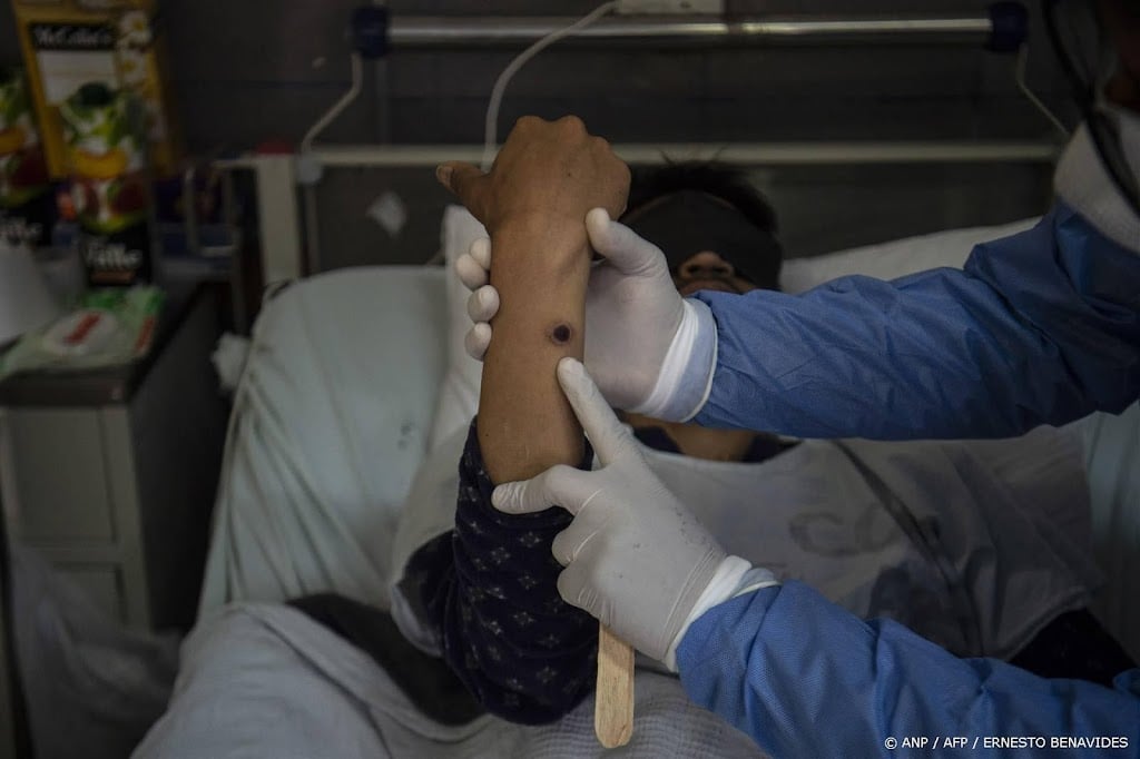 WHO adviseert door mpox getroffen landen vaccinaties te plannen