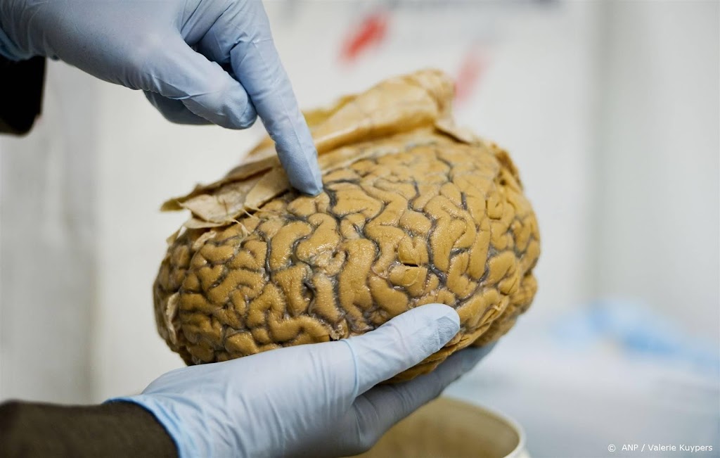 UMC Utrecht: hersenen pas langzamer na de dertig