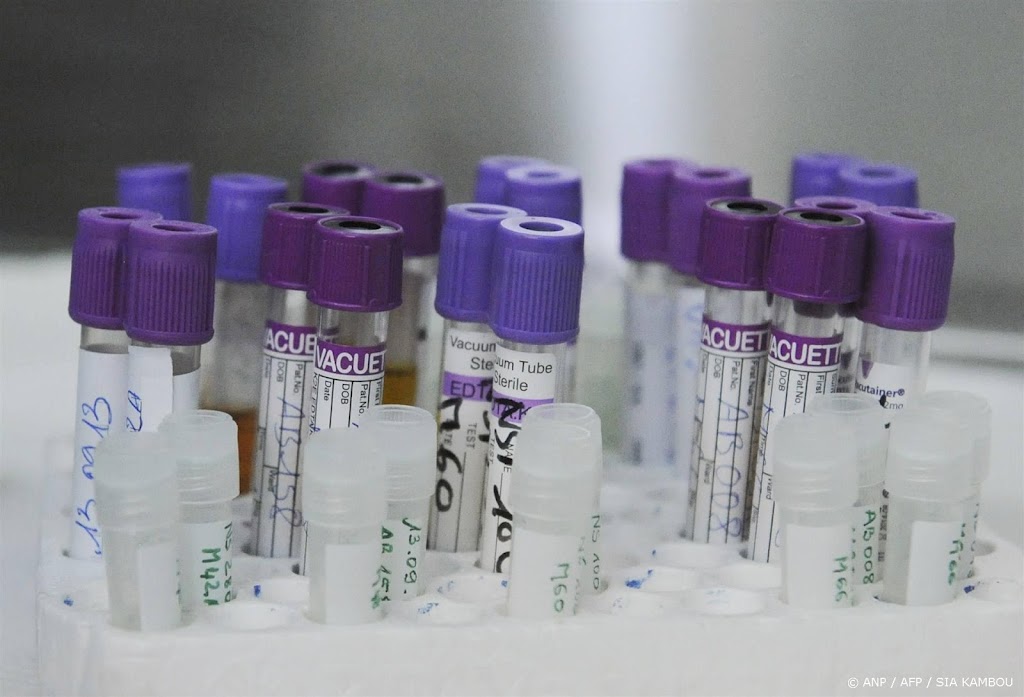 Aidsfonds: stijging hiv-diagnoses is zorgwekkend
