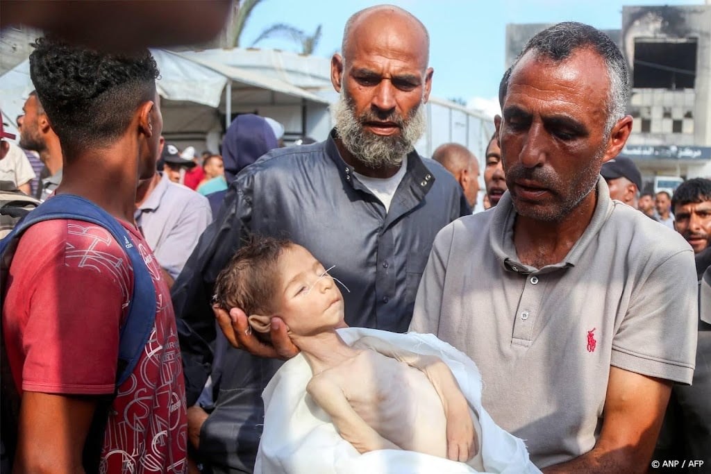 Ziekenhuisdirecteur Gaza: 21 kinderen dood door verhongering