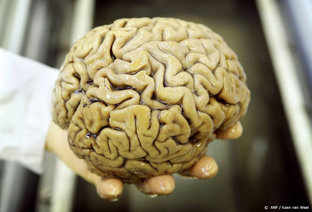 Onderzoek: klein gebiedje in brein kan alzheimer vroeg aantonen 