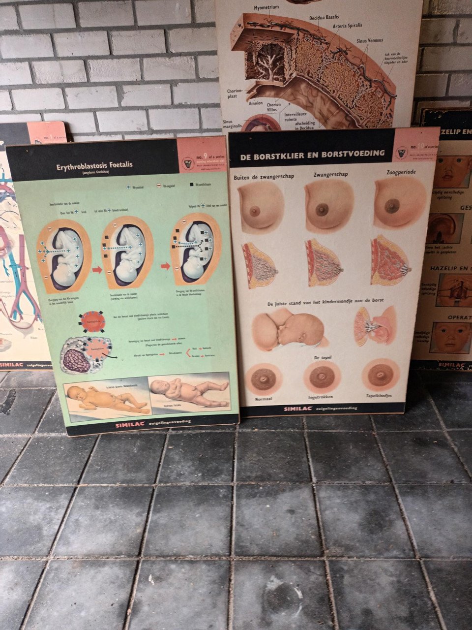 17 vintage lesplaten met koffer