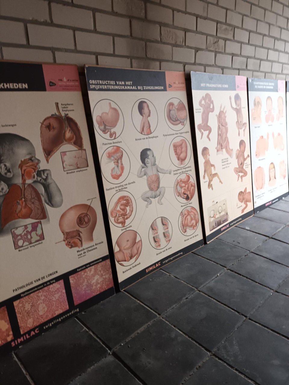 17 vintage lesplaten met koffer