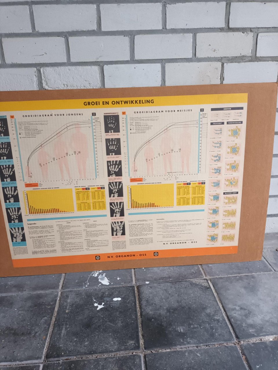17 vintage lesplaten met koffer