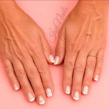 Nagelgel