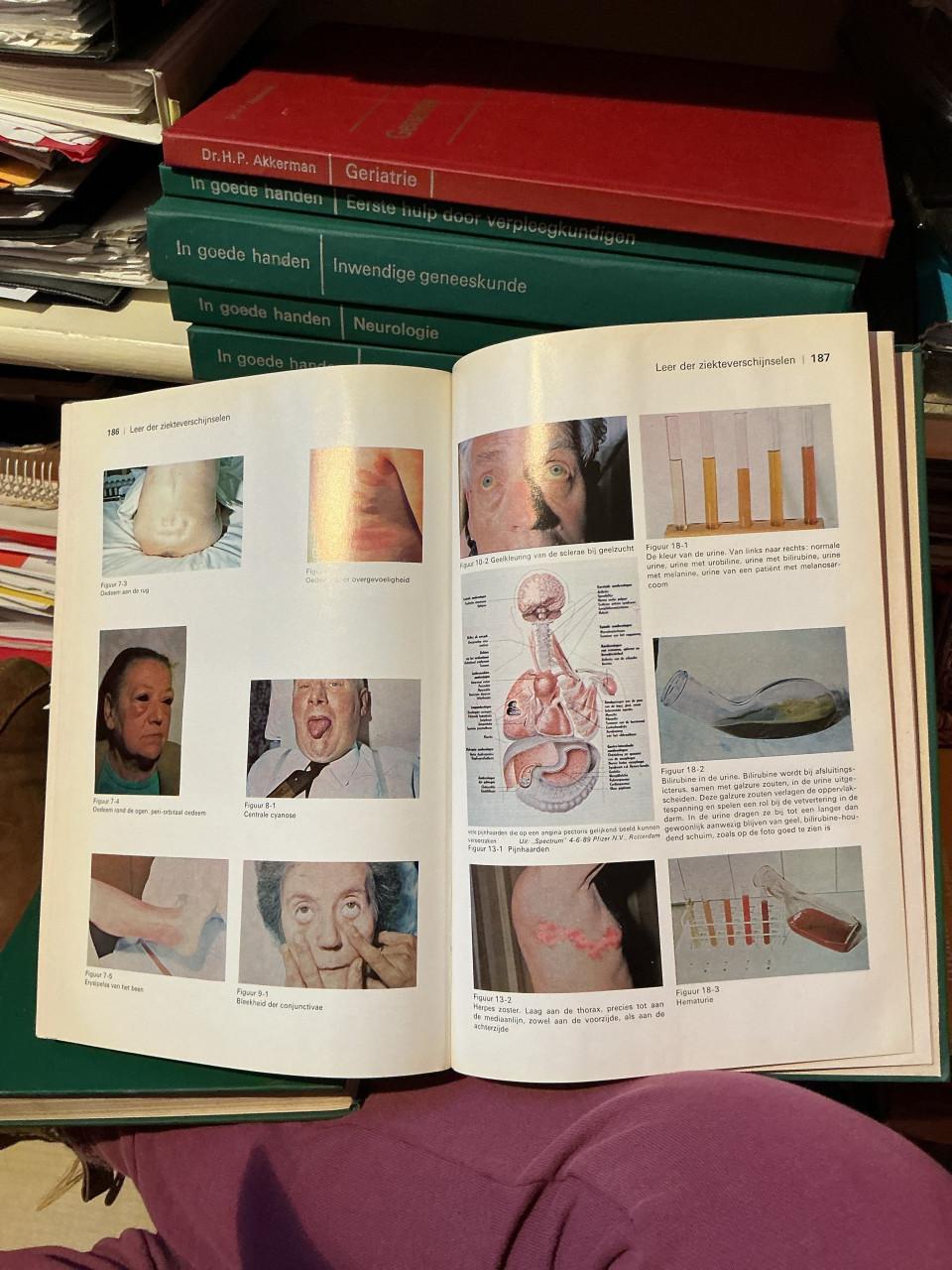 Leerboeken uit de verpleegkundige opleiding ( jaren 70) “ In Goede Handen “