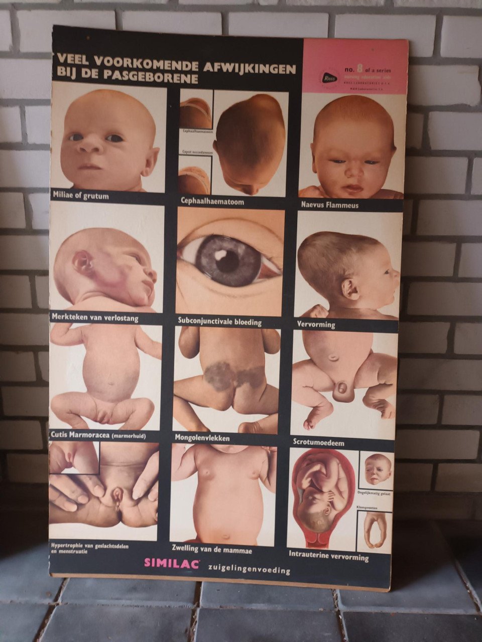17 vintage lesplaten met koffer