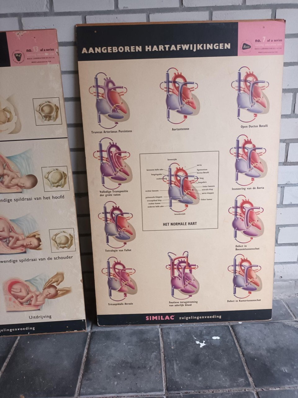 17 vintage lesplaten met koffer