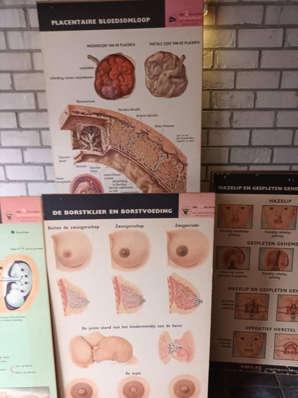 17 vintage lesplaten met koffer