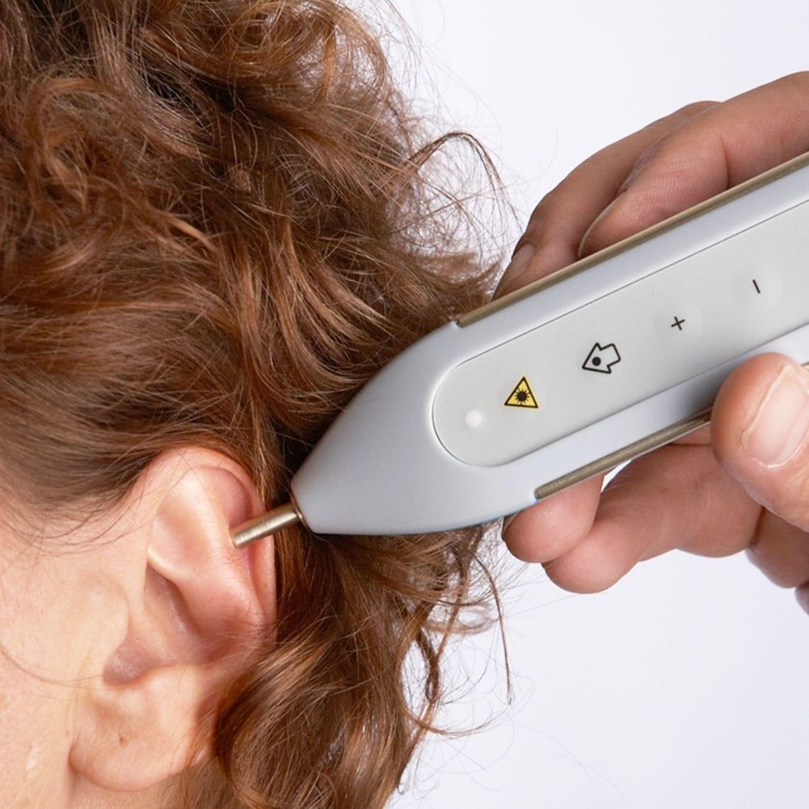 Stoppen met roken door laserbehandeling