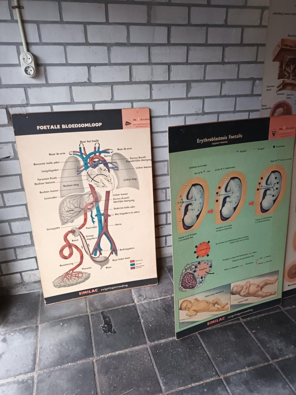 17 vintage lesplaten met koffer